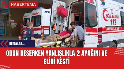 Odun Keserken Yanlışlıkla 2 Ayağını ve Elini Kesti